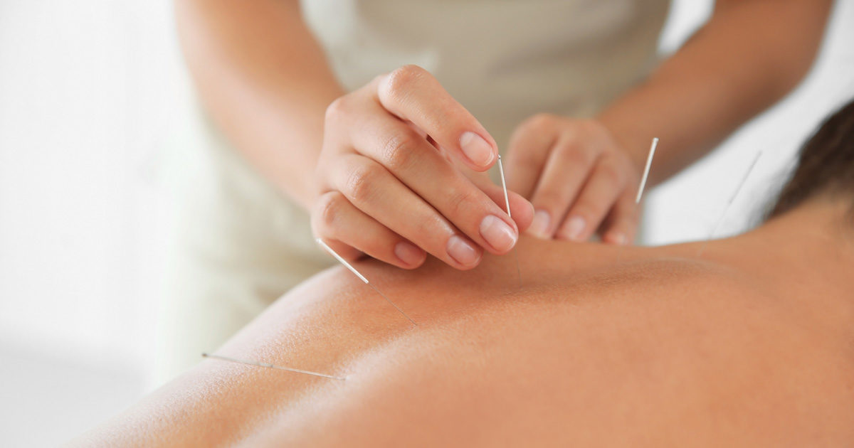 Akupunktura-4-dejstva-1200x630.jpg
